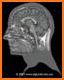 My Brain Anatomy related image