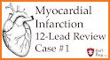 ECG Interpretation MIE related image