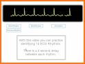 ECG FlashCards - Free related image