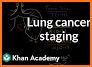 Lung Cancer Stage related image