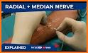 NYSORA Nerve Blocks related image