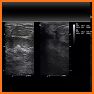 Basic Radiology - SecondLook related image