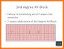 Arrhythmias and Dysrhythmias related image