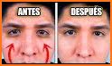 Cómo quitar las ojeras - Antiojeras - Remedios related image