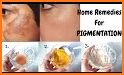 Easy and Effective Home Remedies related image