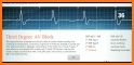 Easy ECG related image