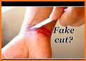 Accident Prank Photo Editor - Fake Injury On Body related image