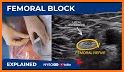 NYSORA Nerve Blocks related image