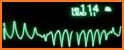 Electrocardiograma ECG Tipos related image