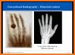 Basic Radiology for medical students related image