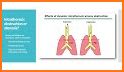 Anesthesia Considerations related image