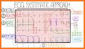 ECG Interpretation: Pkt Guide related image