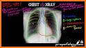 CHEST RADIOLOGY related image