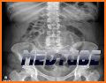 Easy Abdominal X-Ray related image