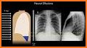 X-Ray Differential Diagnosis related image