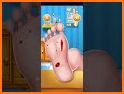 Foot Surgery Doctor Care Game! related image