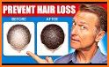 How to grow hair naturally related image