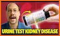 Kidney Check: Home Urine Test related image