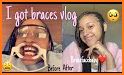 Braces Camera Editor related image