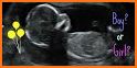 Girl Pregnancy Scanner related image