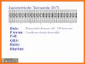 ACLS Rhythm Tutor related image