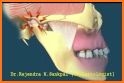 Skull, Teeth & TMJ related image