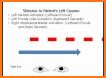 OPK - test for nystagmus related image